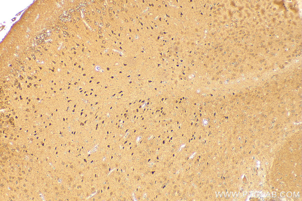 IHC staining of mouse brain using 12539-1-AP