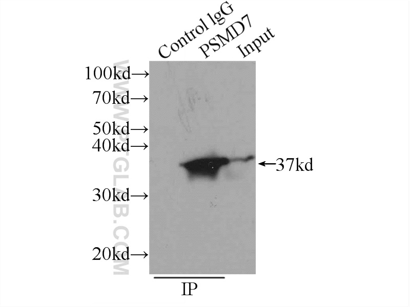 IP experiment of K-562 using 16034-1-AP