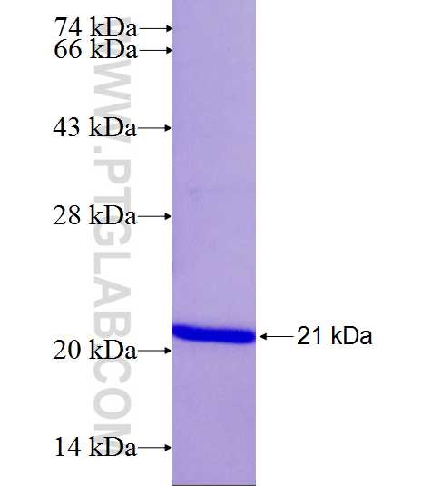 PSMD8 fusion protein Ag26603 SDS-PAGE PSMD8 fusion protein Ag26603 SDS-PAGE