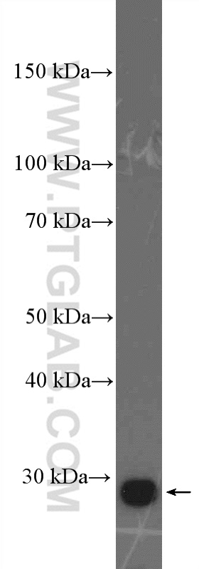 WB analysis of A549 using 26922-1-AP