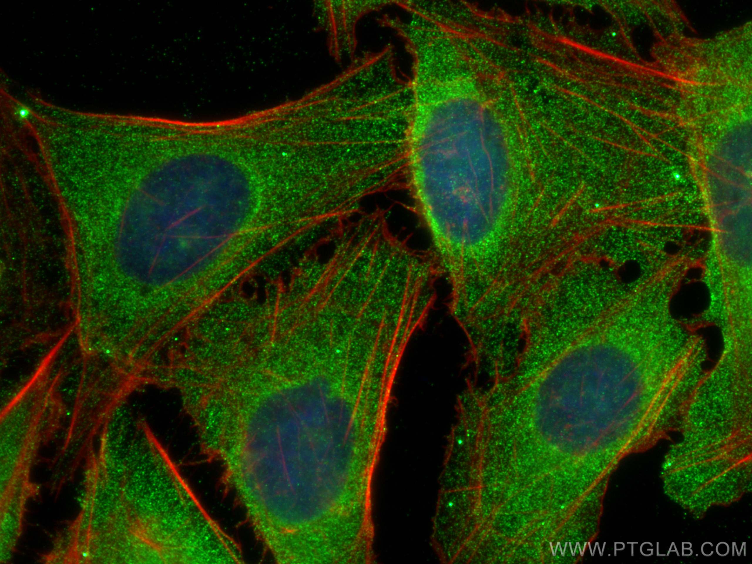 IF Staining of U2OS using 67338-1-Ig