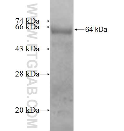 PSMD9 fusion protein Ag0846 SDS-PAGE PSMD9 fusion protein Ag0846 SDS-PAGE
