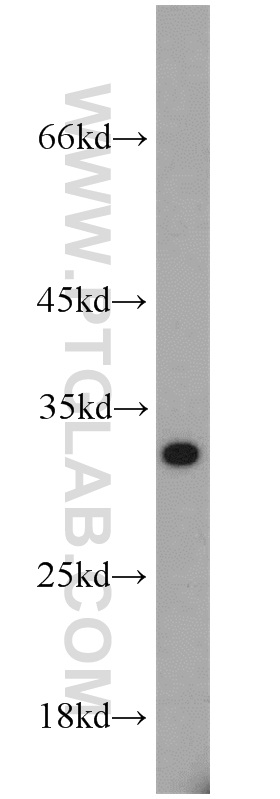 WB analysis of mouse spleen using 10543-1-AP