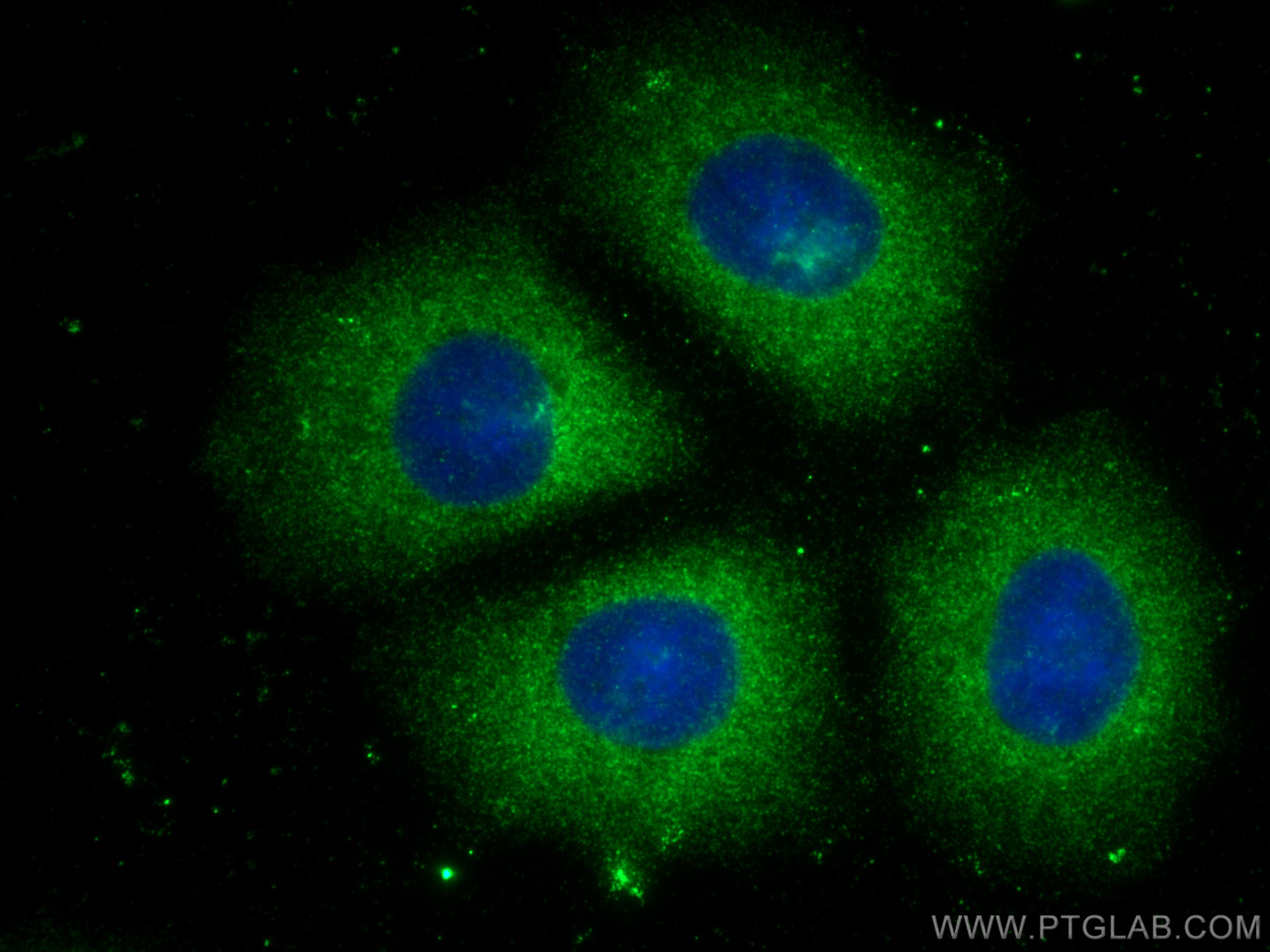 IF Staining of MCF-7 using 67928-1-Ig (same clone as 67928-1-PBS)