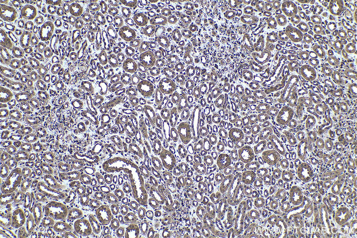 IHC staining of human kidney using 12937-2-AP