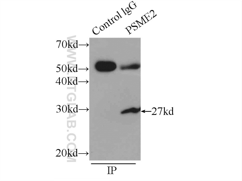 IP experiment of MCF-7 using 12937-2-AP