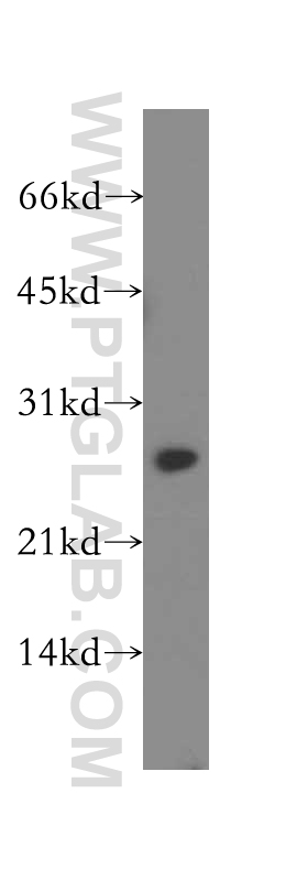 WB analysis of MCF-7 using 12937-2-AP