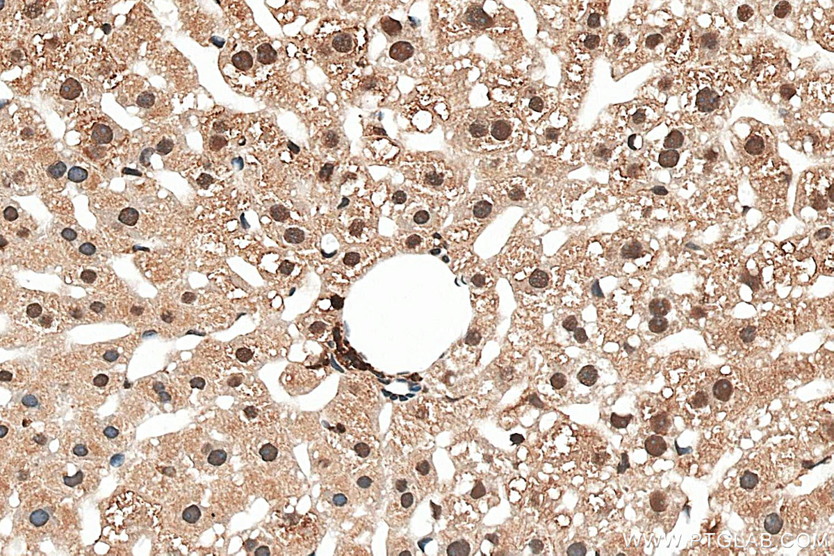 IHC staining of mouse liver using 87958-1-RR (same clone as 87958-1-PBS) IHC staining of mouse liver using 87958-1-RR (same clone as 87958-1-PBS)