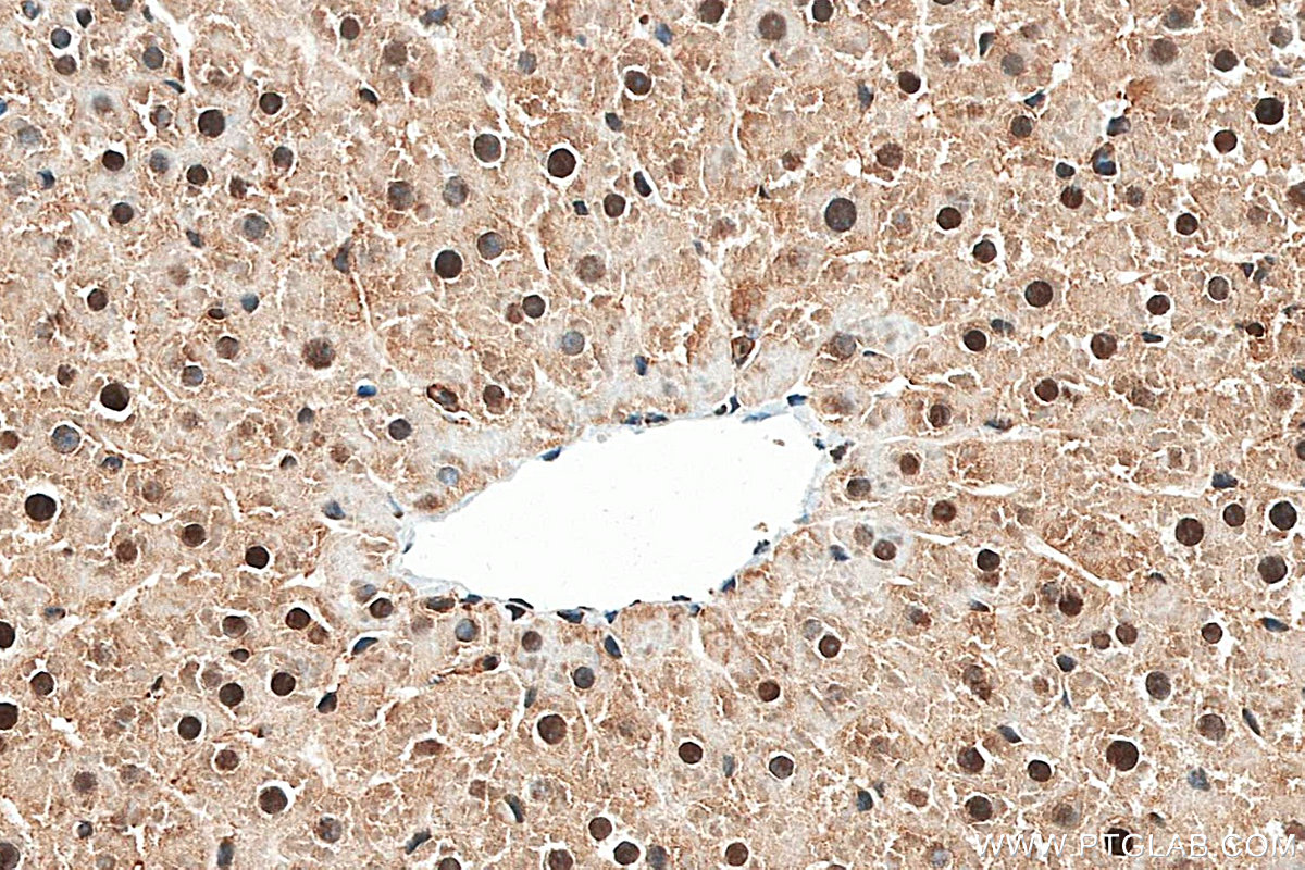 IHC staining of rat liver using 87958-1-RR (same clone as 87958-1-PBS) IHC staining of rat liver using 87958-1-RR (same clone as 87958-1-PBS)