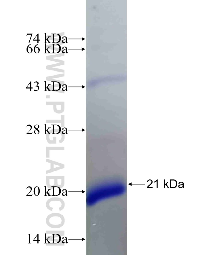 PSME3 fusion protein Ag31985 SDS-PAGE PSME3 fusion protein Ag31985 SDS-PAGE
