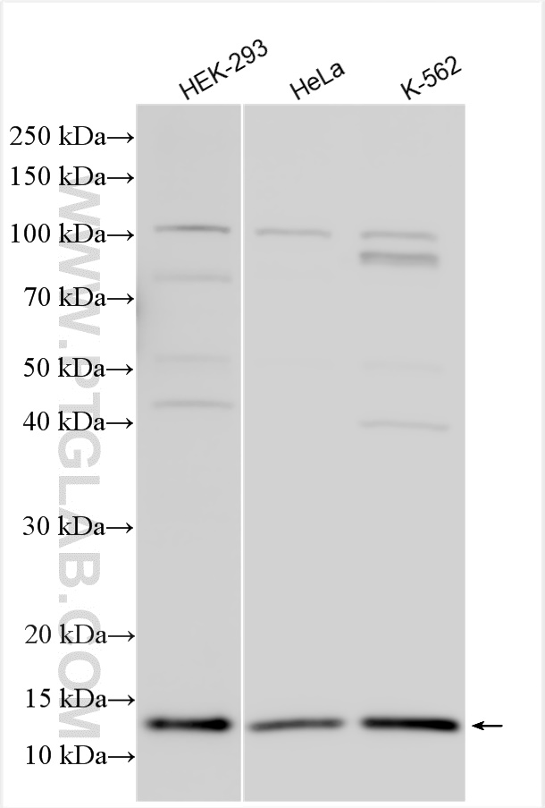 WB analysis using 15601-1-AP