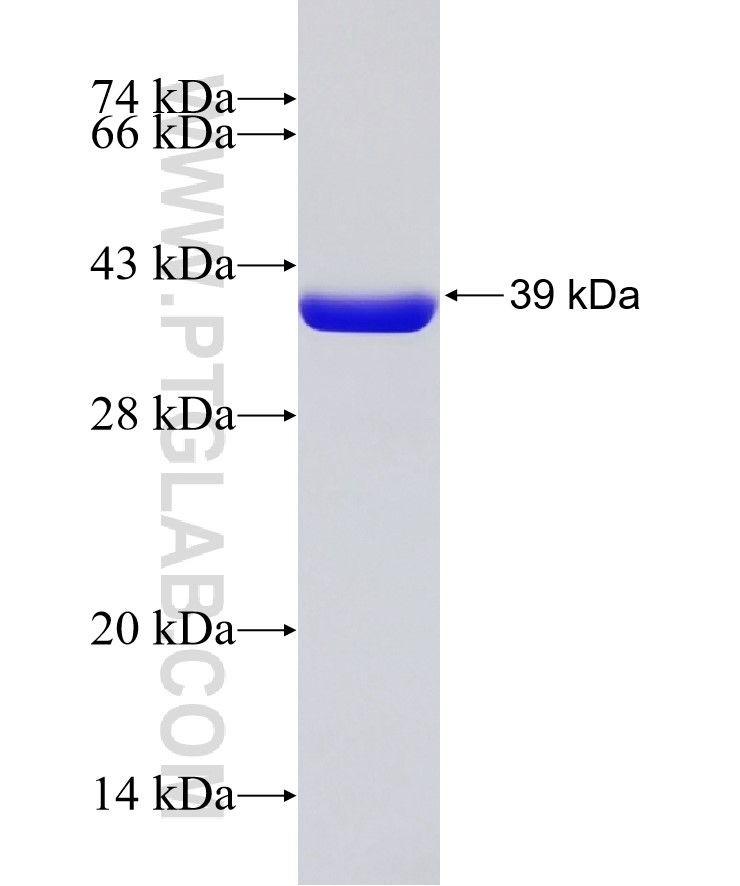 PSMG3 fusion protein Ag7984 SDS-PAGE