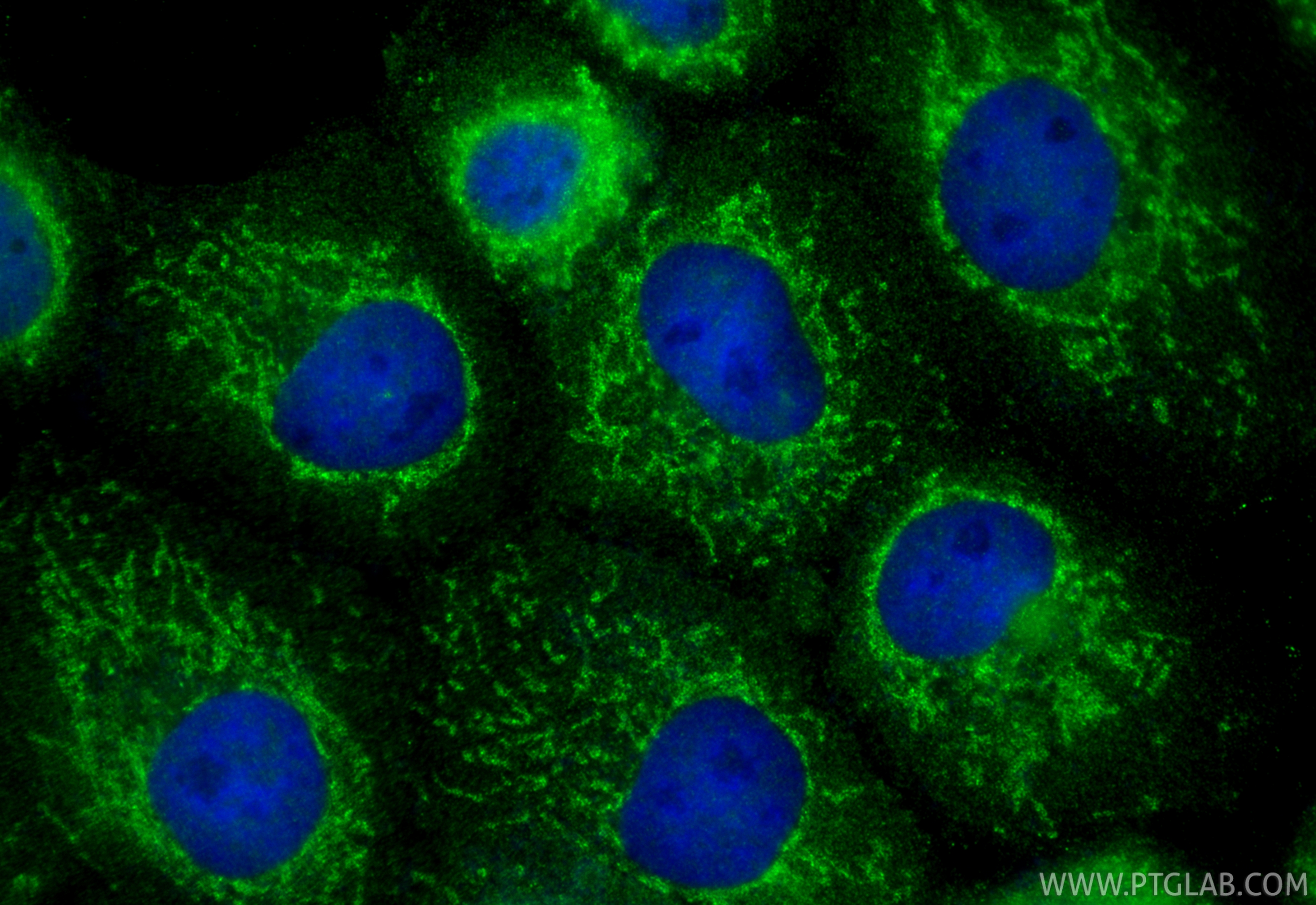 IF Staining of A431 using 31201-1-AP (same clone as 31201-1-PBS)