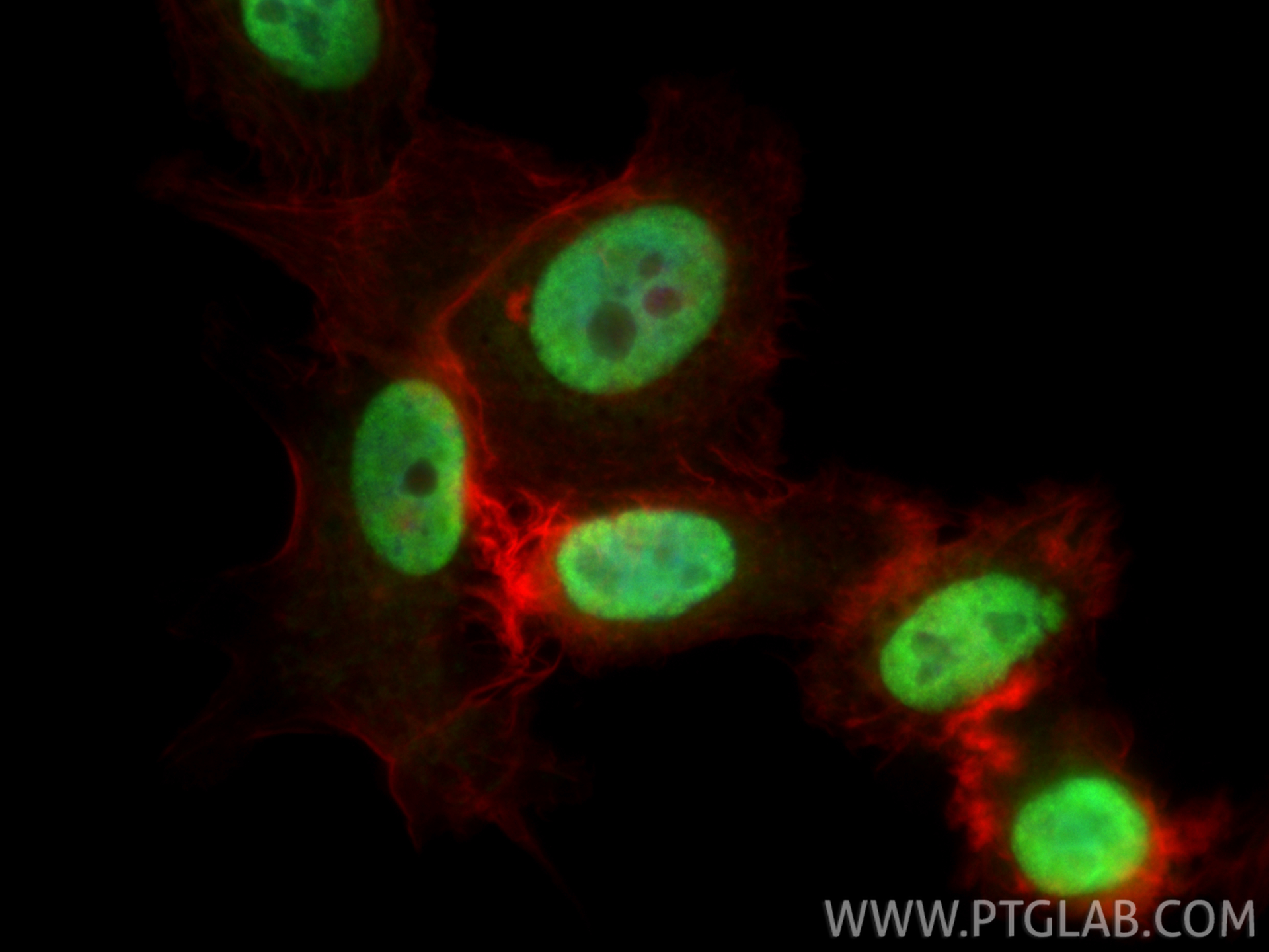 IF Staining of PC-3 using 16714-1-AP