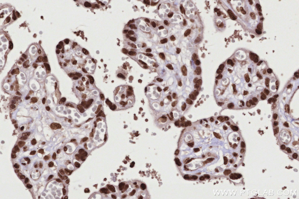 IHC staining of human placenta using 16714-1-AP