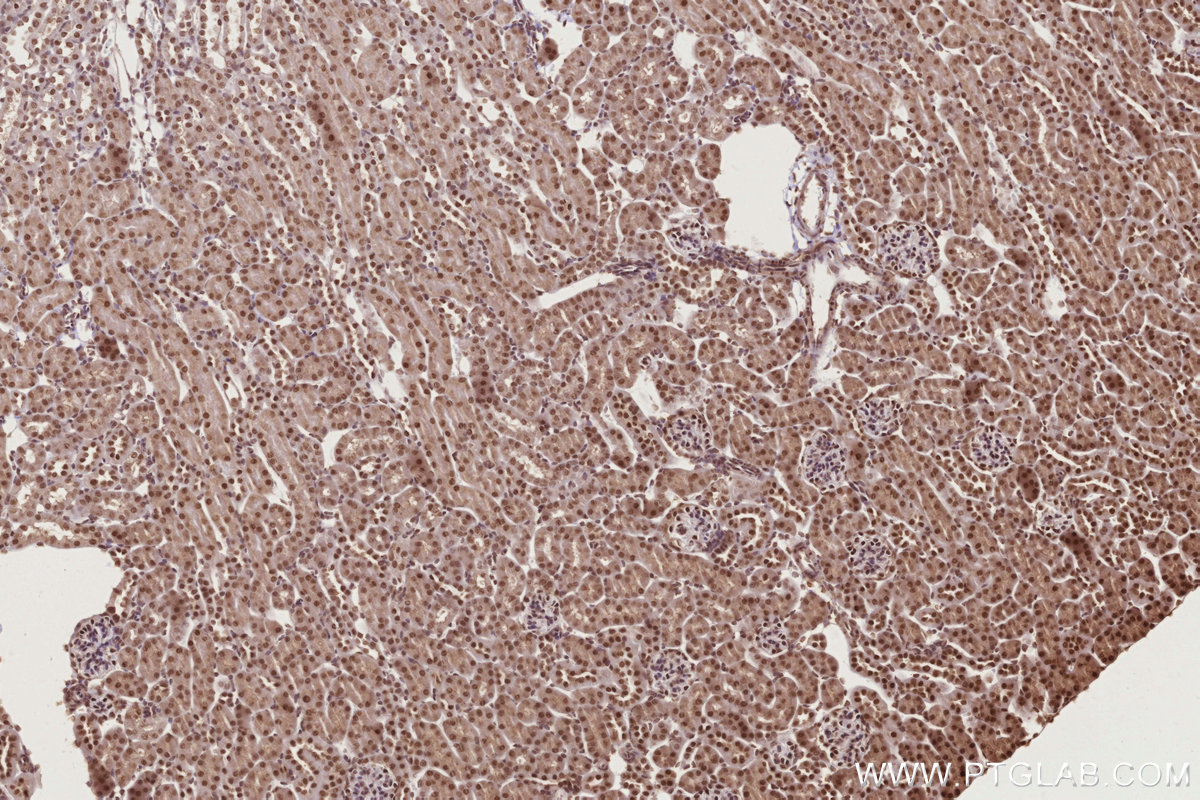 IHC staining of mouse kidney using 16714-1-AP