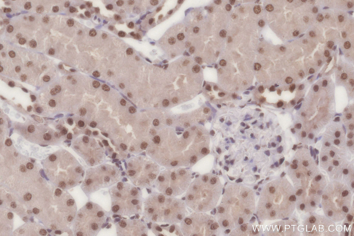 IHC staining of rat kidney using 16714-1-AP