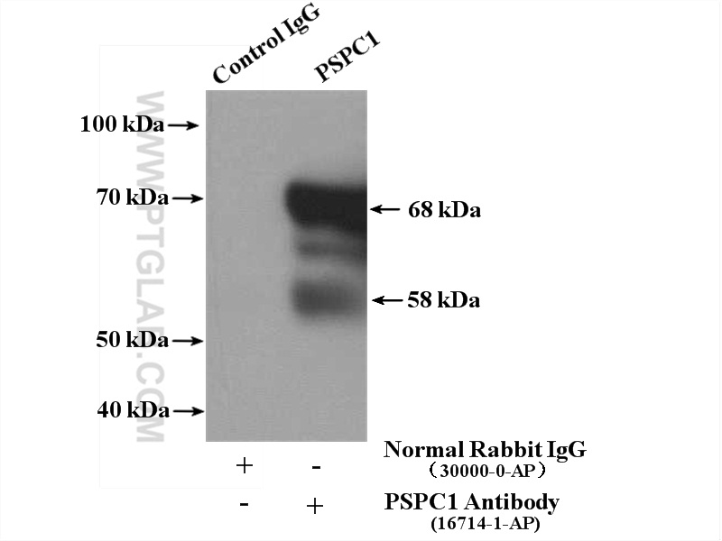 IP experiment of HEK-293 using 16714-1-AP