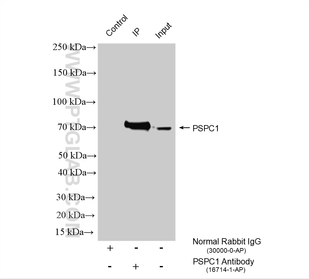 IP experiment of PC-3 using 16714-1-AP