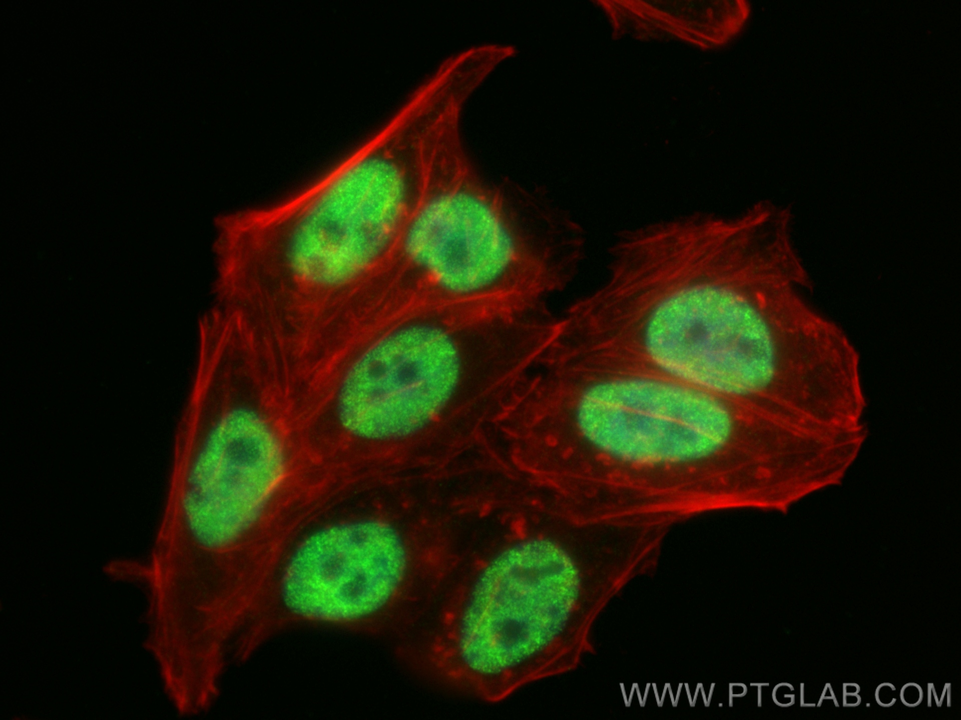 IF Staining of HepG2 using 84657-5-RR