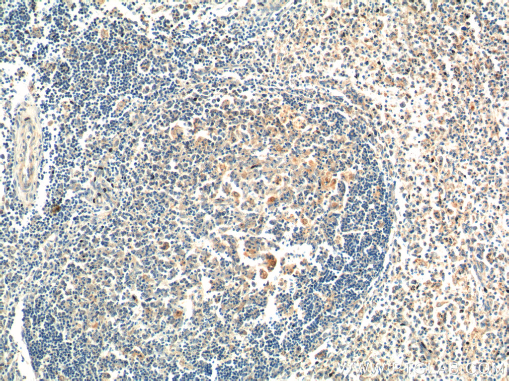 IHC staining of human spleen using 14513-1-AP