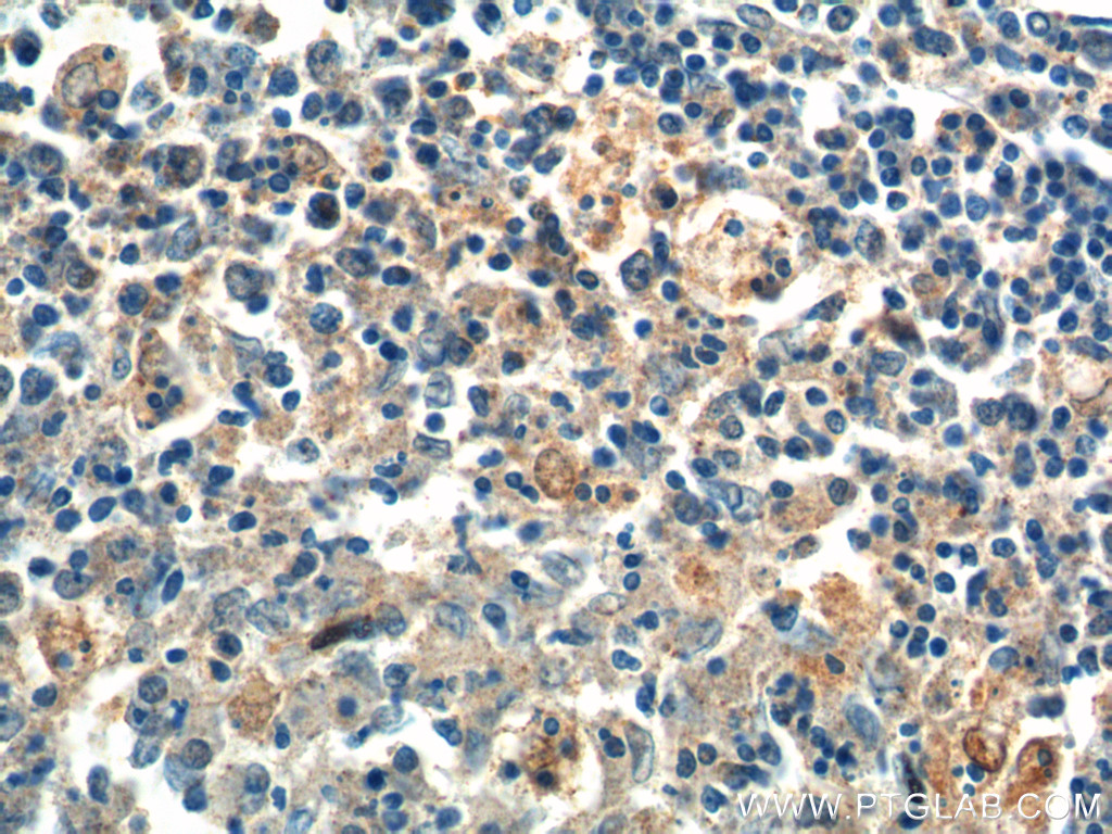 IHC staining of human spleen using 14513-1-AP