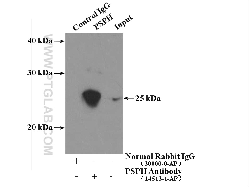 IP experiment of HL-60 using 14513-1-AP