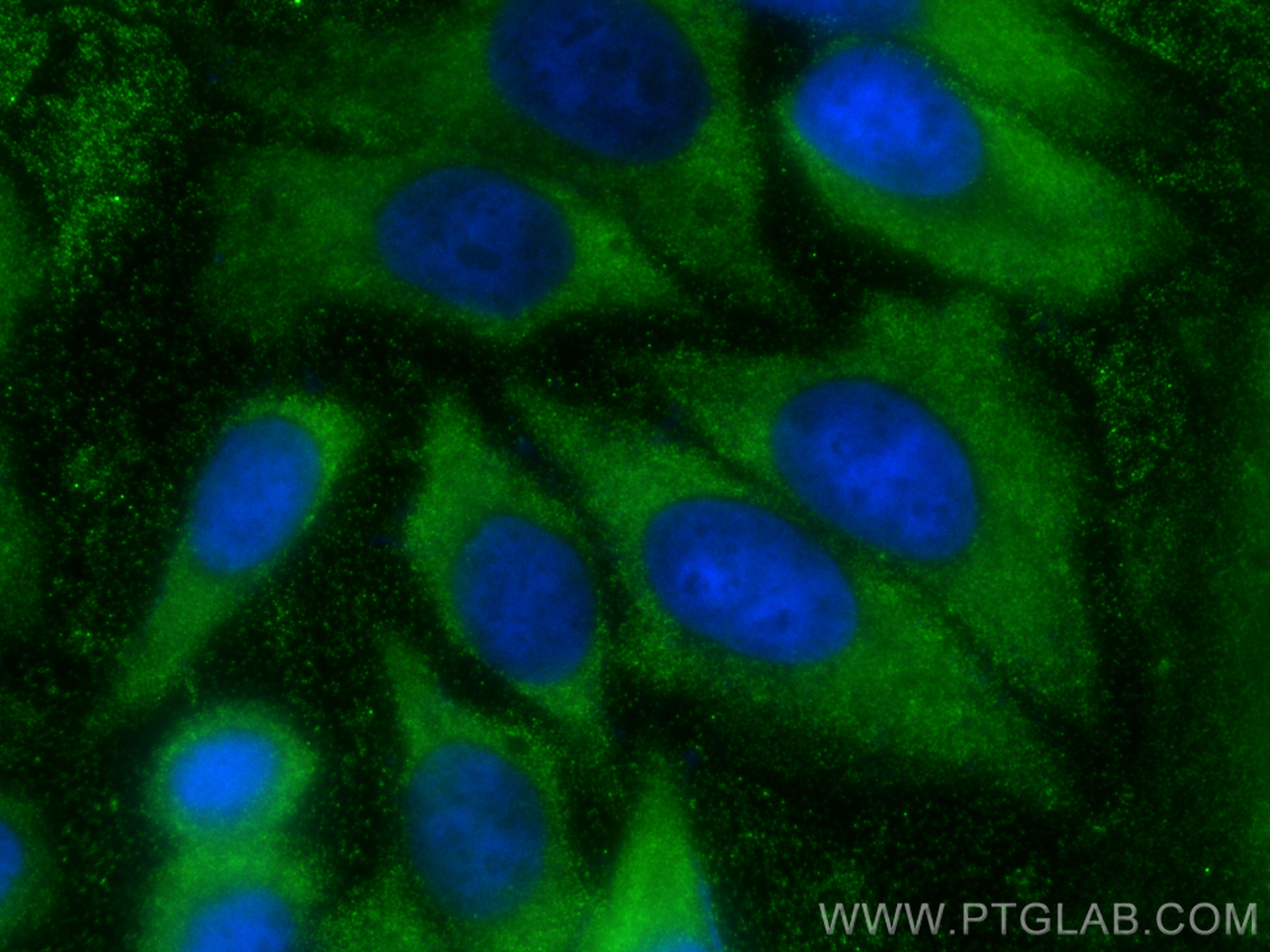 IF Staining of HepG2 using 68500-1-Ig