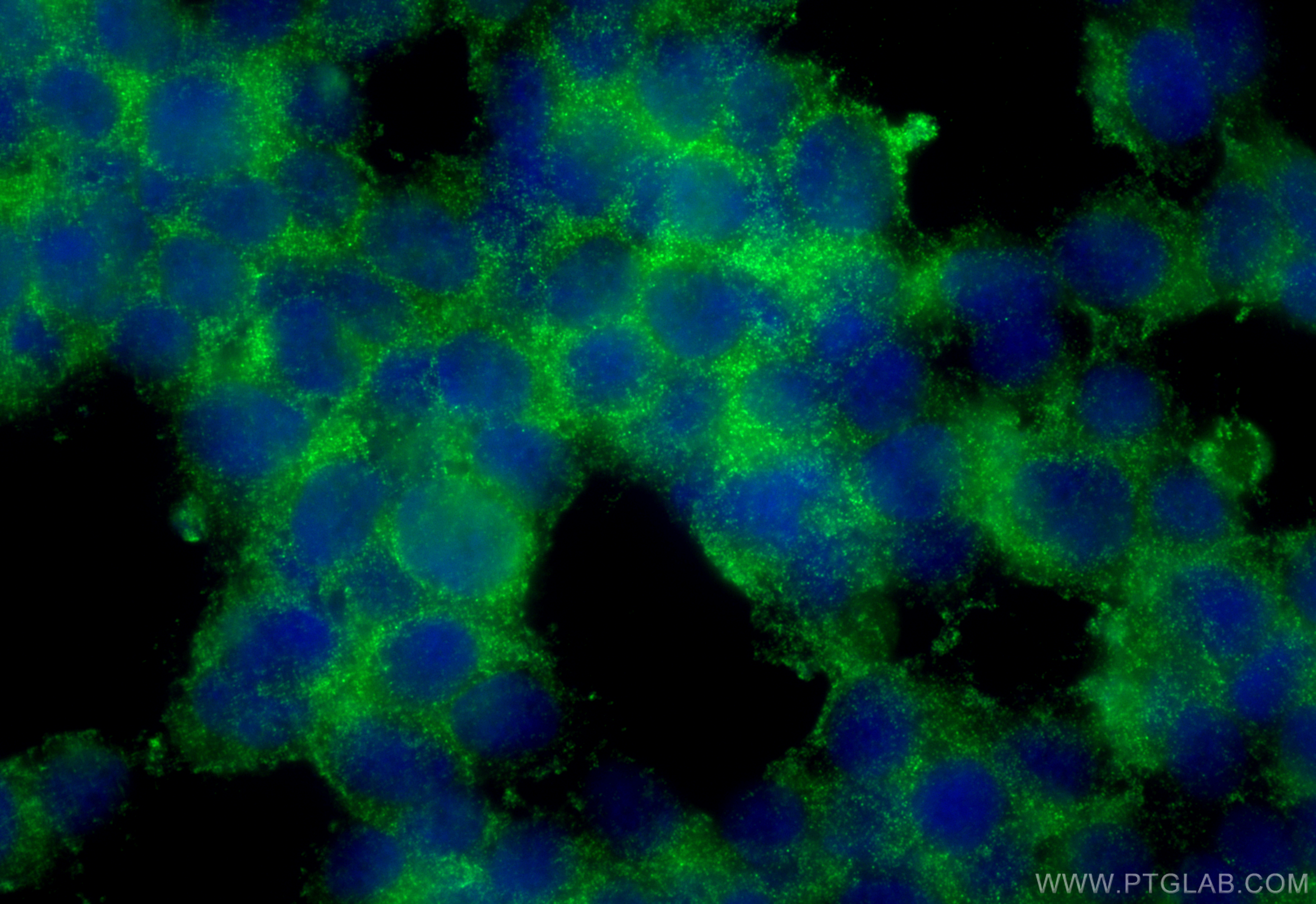 IF Staining of SH-SY5Y using 19713-1-AP
