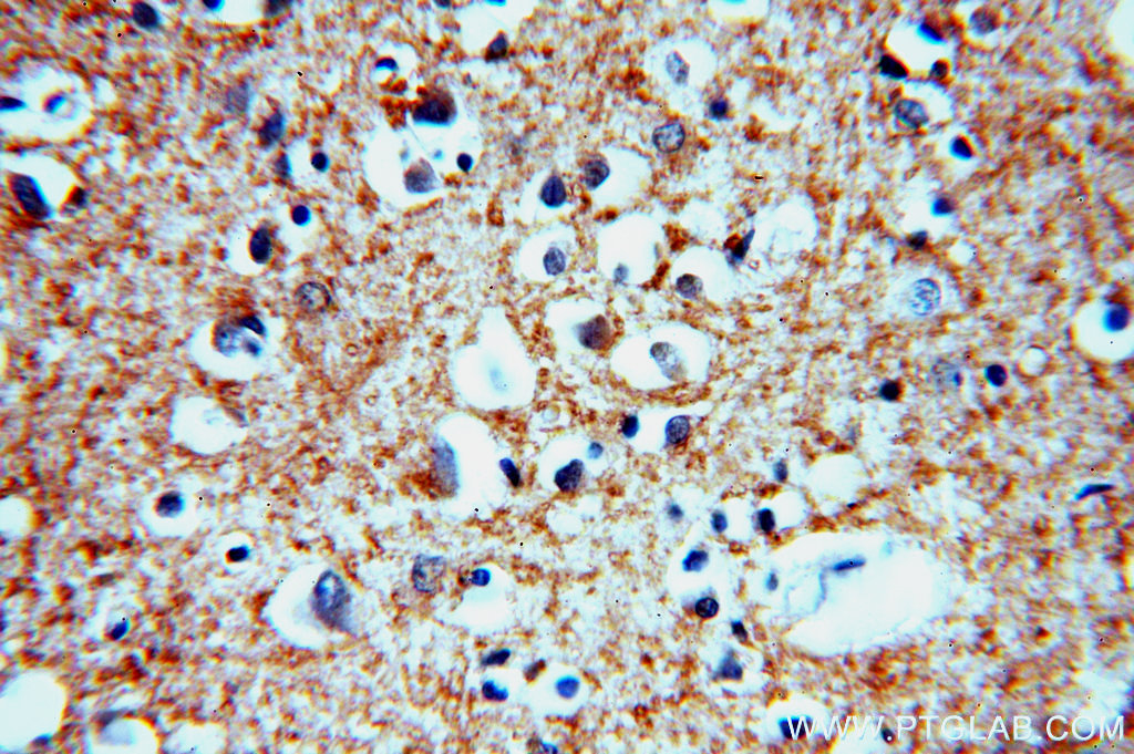 IHC staining of human brain using 19713-1-AP