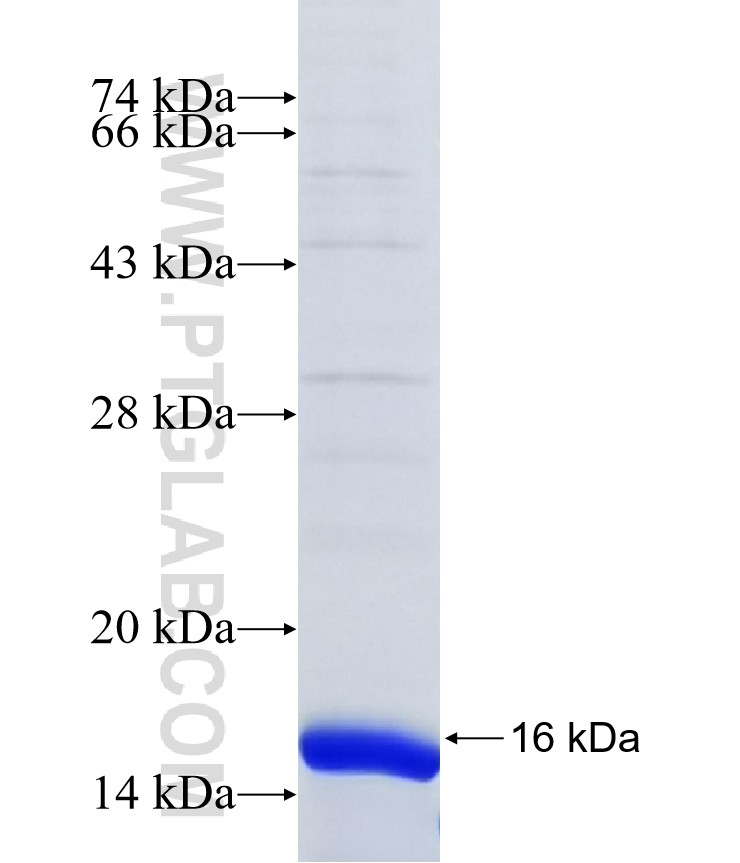 PSS2 fusion protein Ag16936 SDS-PAGE PSS2 fusion protein Ag16936 SDS-PAGE