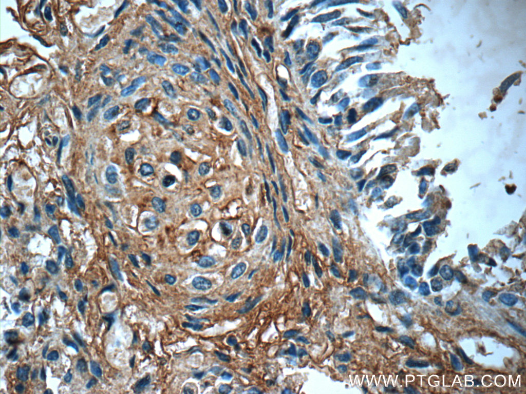 IHC staining of human lung using 20921-1-AP