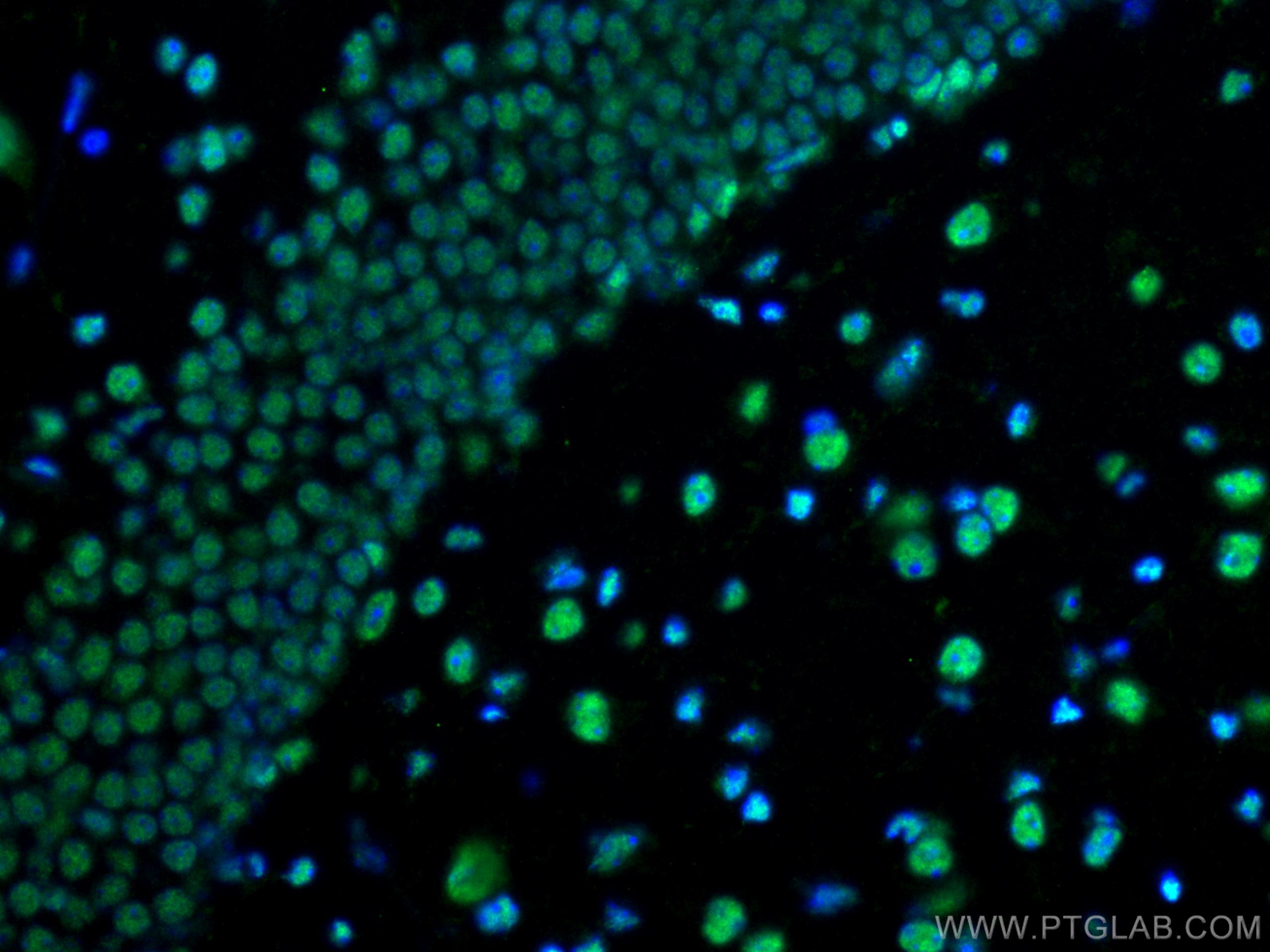IF Staining of mouse brain using 12582-1-AP