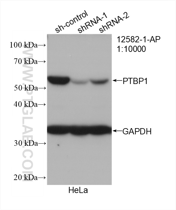 WB analysis of HeLa using 12582-1-AP