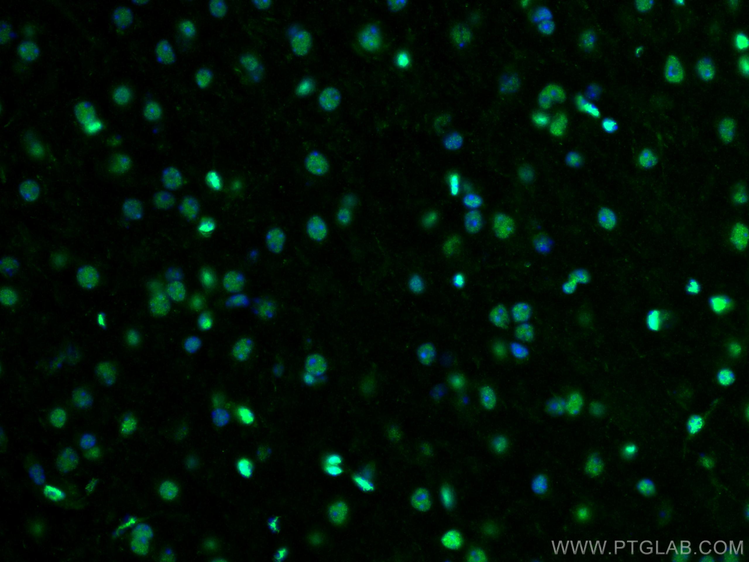 IF Staining of mouse brain using 55181-1-AP