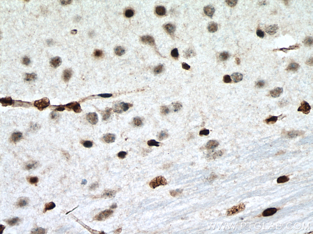 IHC staining of mouse brain using 55181-1-AP