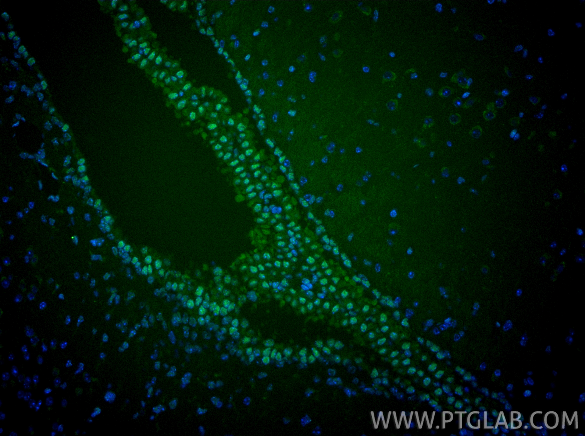 IF Staining of mouse brain using CL488-67462 IF Staining of mouse brain using CL488-67462