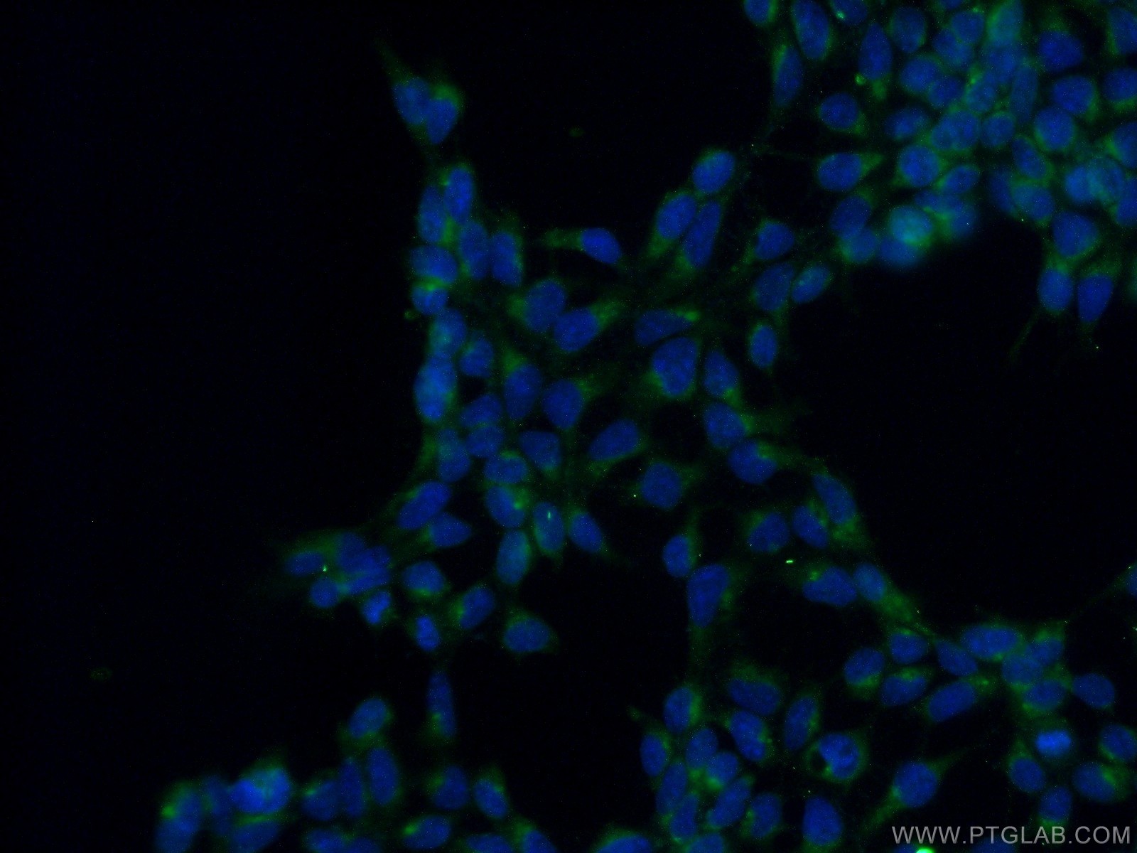 IF Staining of HEK-293 using 25158-1-AP