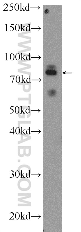 PTCD3