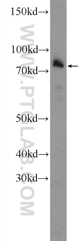 WB analysis of mouse embryo using 25158-1-AP