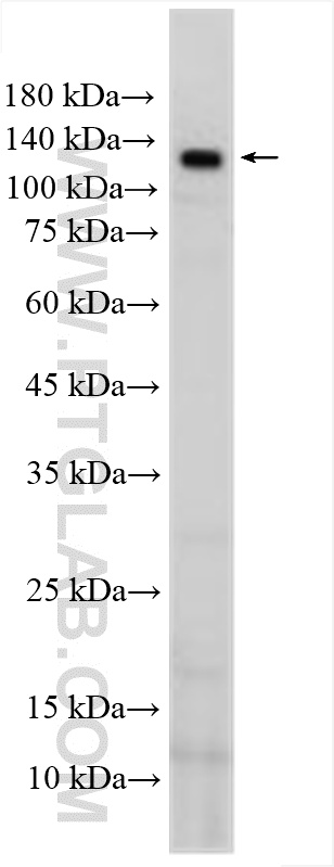 WB analysis of rat liver using 55091-1-AP WB analysis of rat liver using 55091-1-AP