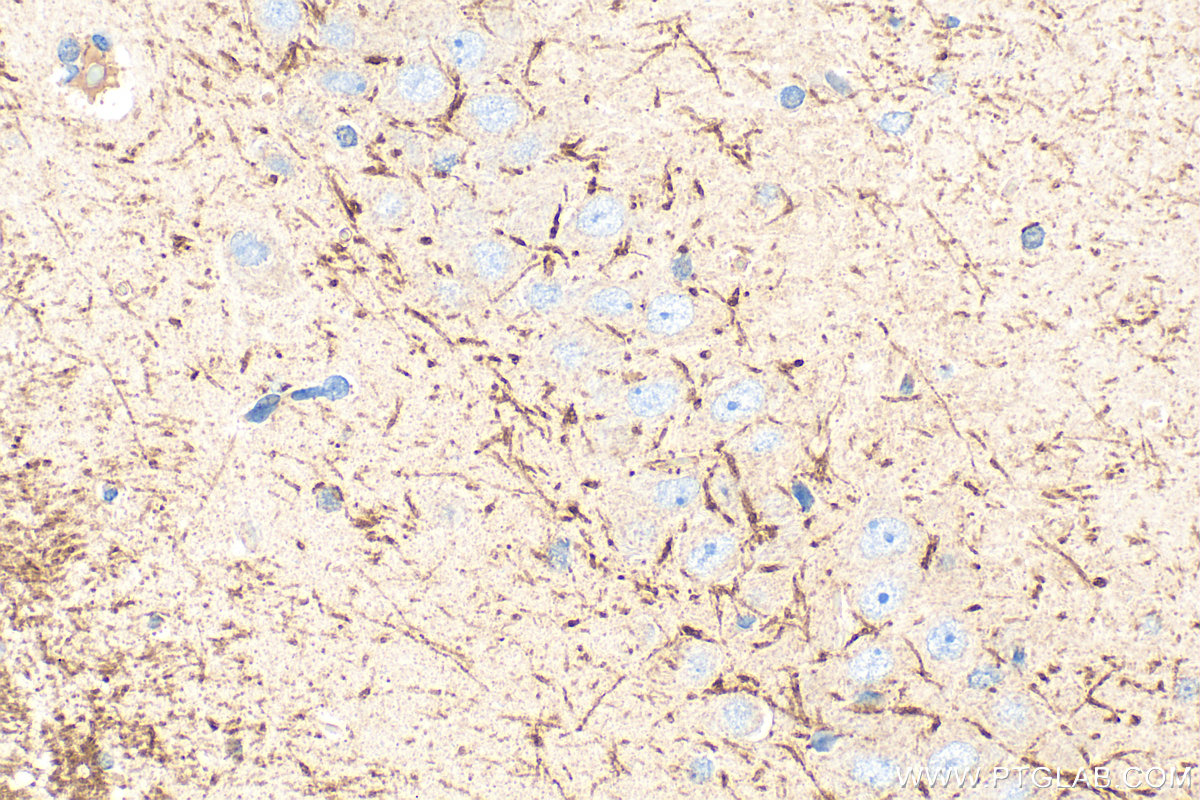 IHC staining of rat brain using 33489-1-AP IHC staining of rat brain using 33489-1-AP