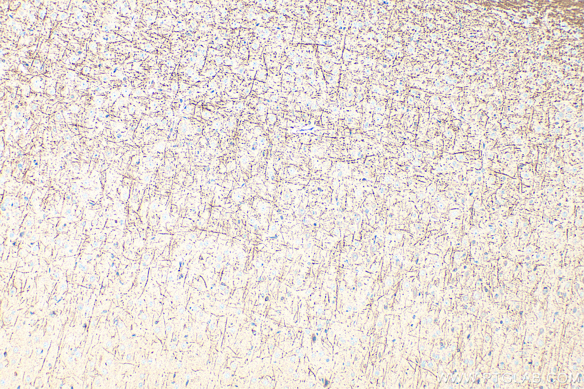 IHC staining of rat brain using 33489-1-AP IHC staining of rat brain using 33489-1-AP
