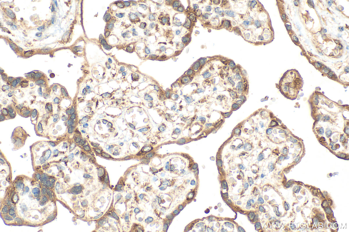 IHC staining of human placenta using 20820-1-AP