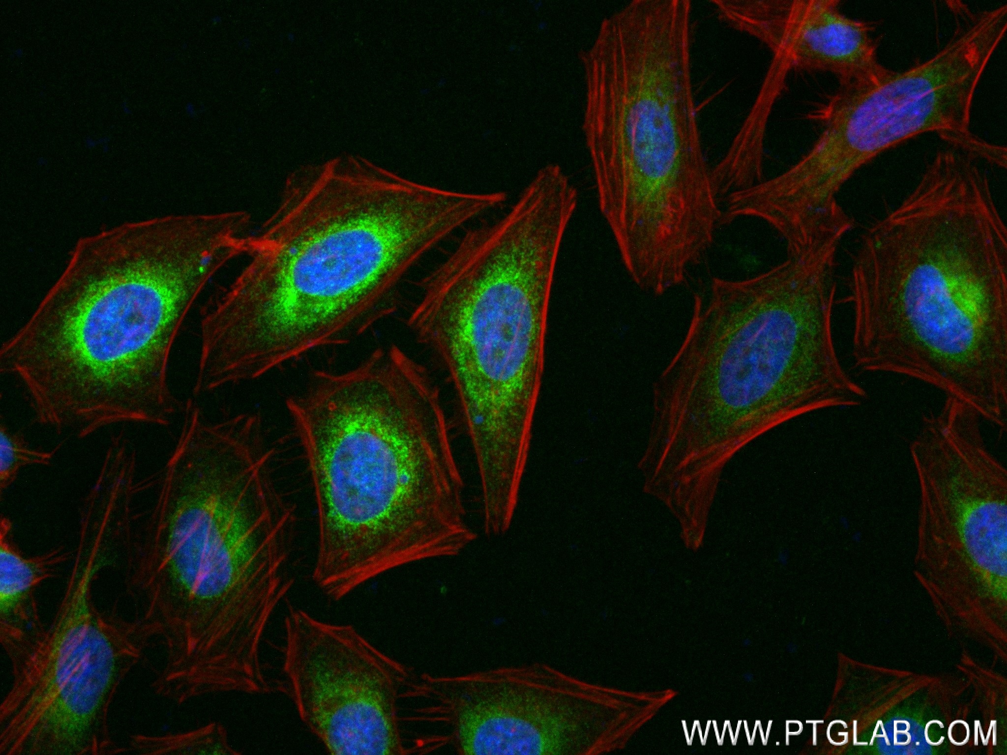 IF Staining of Hela using 83421-1-RR (same clone as 83421-1-PBS)