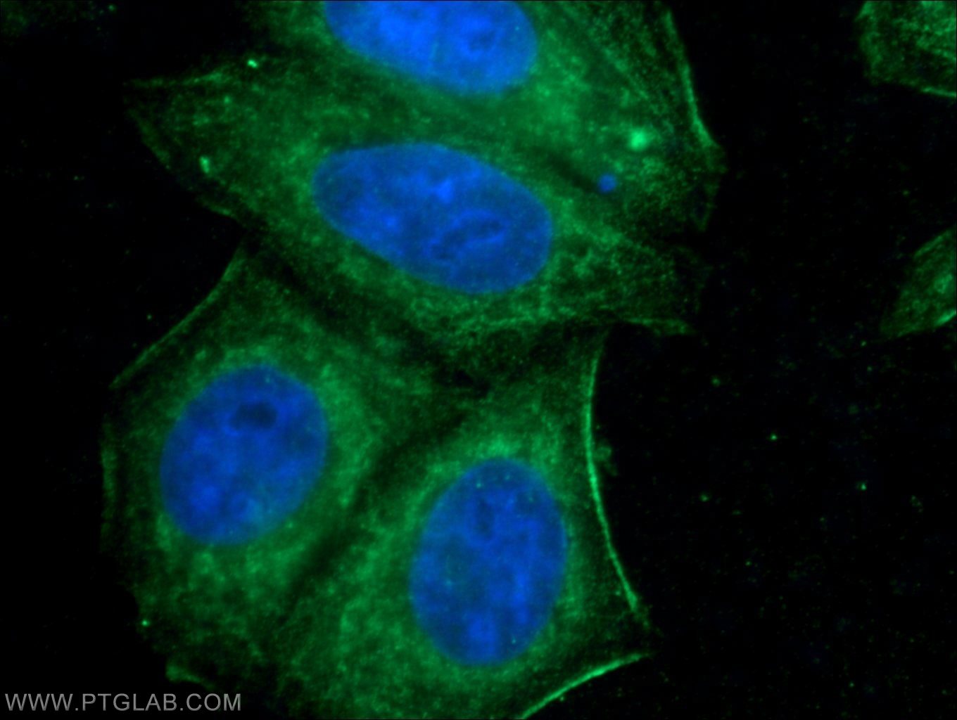 PTEN Monoclonal antibody