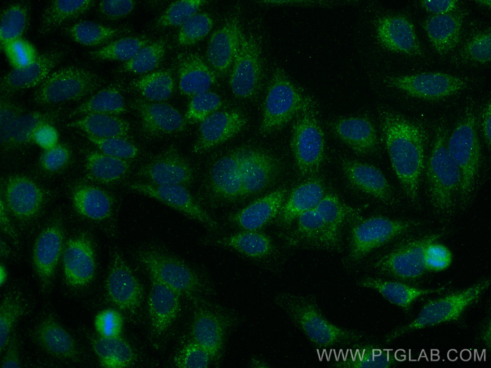 IF Staining of HepG2 using 60300-1-Ig