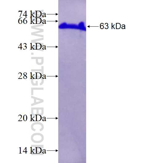 PTEN fusion protein Ag17274 SDS-PAGE