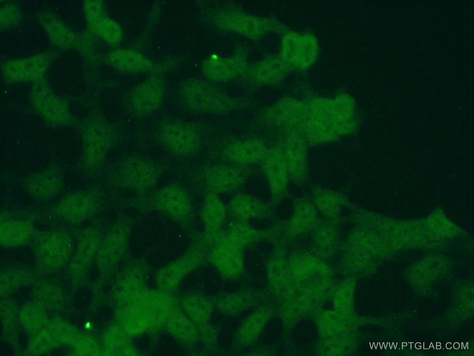 IF Staining of HEK-293 using 11191-1-AP