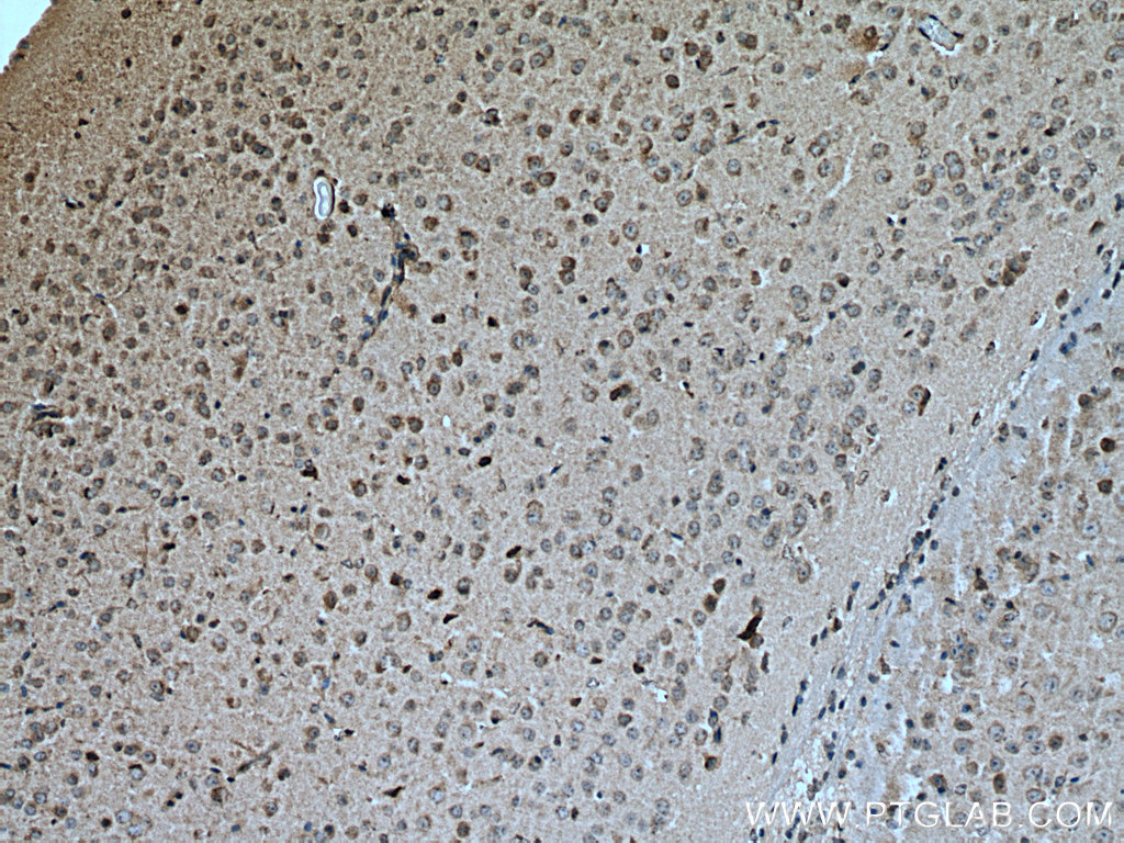 IHC staining of mouse brain using 10754-2-AP